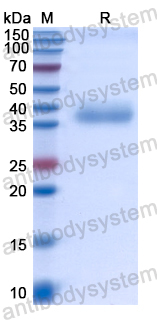 Recombinant Human CAMKK2 Protein, N-His