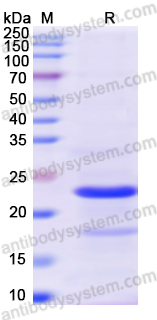 Recombinant Human AMELX Protein, N-His