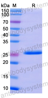Recombinant Human GAD1/GAD67 Protein, N-His