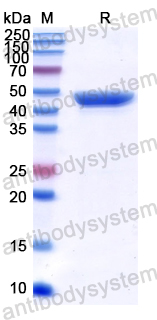 Recombinant Human CYTH2 Protein, N-His