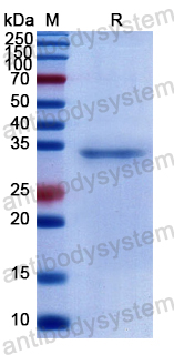 Recombinant Human NELL2 Protein, N-His