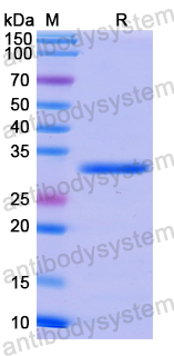 Recombinant Human NOTCH4 Protein, N-His