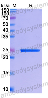 Recombinant Human SDF2 Protein, N-His