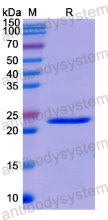 Recombinant Human PARK7 Protein, N-His