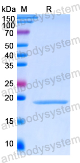 Recombinant Human NEU1/Sialidase-1 Protein, N-His