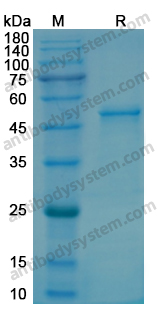 Recombinant Human LGMN Protein, N-His