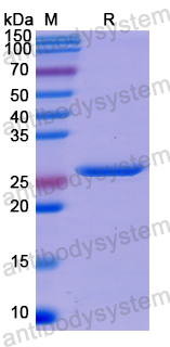 Recombinant Human PLIN2 Protein, N-His