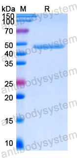Recombinant Human MMP19 Protein, N-His