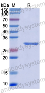 Recombinant Human NUP88 Protein, N-His