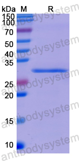 Recombinant Human P2RX7 Protein, N-His