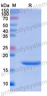 Recombinant Human TSC22D3 Protein, N-His