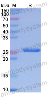 Recombinant Human SCAF11 Protein, N-His