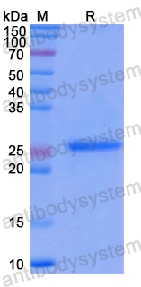 Recombinant Human EPYC Protein, N-His