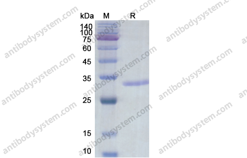 Recombinant Human GPA33 Protein, N-His