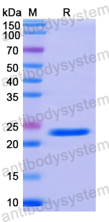 Recombinant Human CIB1 Protein, N-His