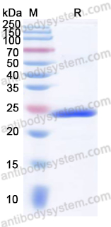 Recombinant Human SMO Protein, N-His