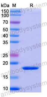 Recombinant Human MYD88 Protein, N-His