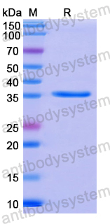 Recombinant Human HAUS7 Protein, N-His