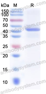 Recombinant Human DUSP9 Protein, N-His
