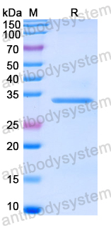 Recombinant Human PKP2 Protein, N-His