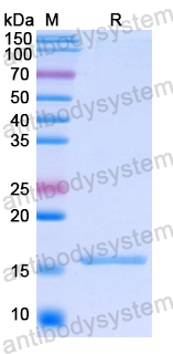Recombinant Human RARRES2 Protein, N-His