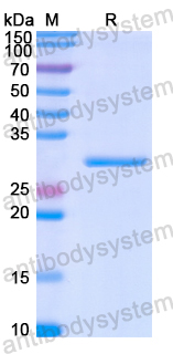 Recombinant Human MYOC Protein, N-His