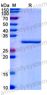 Recombinant Human TEP1 Protein, N-His