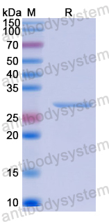 Recombinant Human CCDC3 Protein, N-His