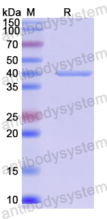 Recombinant Human HEPH Protein, N-His