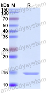 Recombinant Human MESP1 Protein, N-His