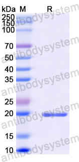 Recombinant Human PYGO2 Protein, N-His-SUMO