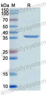 Recombinant Human AGMAT Protein, N-GST