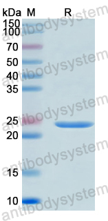 Recombinant Human DIDO1 Protein, N-His