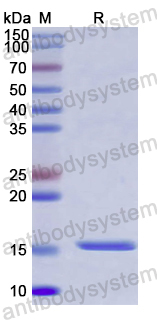 Recombinant Human H2AJ Protein, N-His