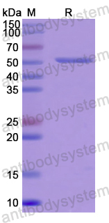Recombinant Human CHRDL1 Protein, N-His