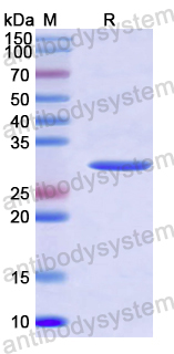 Recombinant Human TRAF4 Protein, N-His