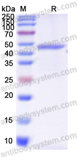 Recombinant Human ACAT2 Protein, N-His