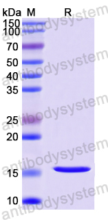 Recombinant Human SGPP1 Protein, N-His