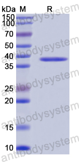 Recombinant Human ASPN Protein, N-His