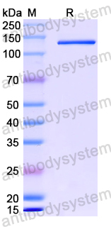 Recombinant Human PAPPA2 Protein, N-His