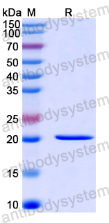 Recombinant Human CD290/TLR10 Protein, N-His