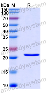 Recombinant Human ITPA Protein, N-His
