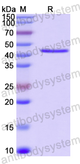 Recombinant Human HDAC8 Protein, N-His