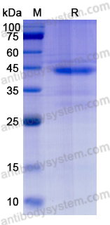 Recombinant Human HDAC8 Protein, C-His