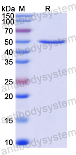 Recombinant Human ANGPTL4 Protein, N-GST