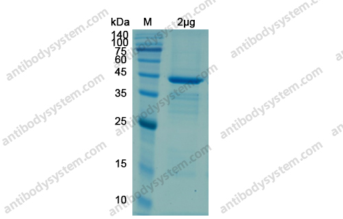 Recombinant Human ACE2 Protein, N-His