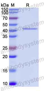 Recombinant Human ACE2 Protein, N-His