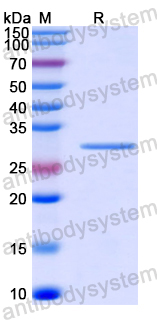 Recombinant Human AGXT2 Protein, N-His