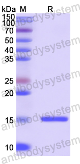 Recombinant Human REG4 Protein, N-His