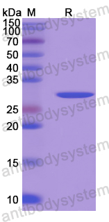 Recombinant Human CPEB1 Protein, N-His